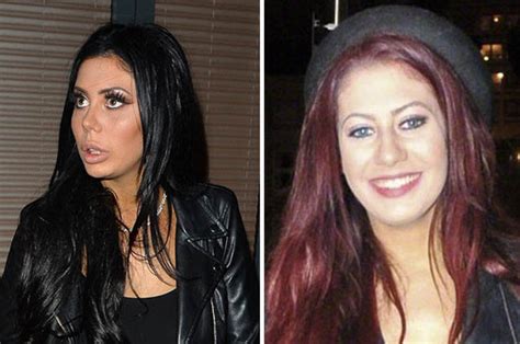 chloe ferry cosmetic surgery.